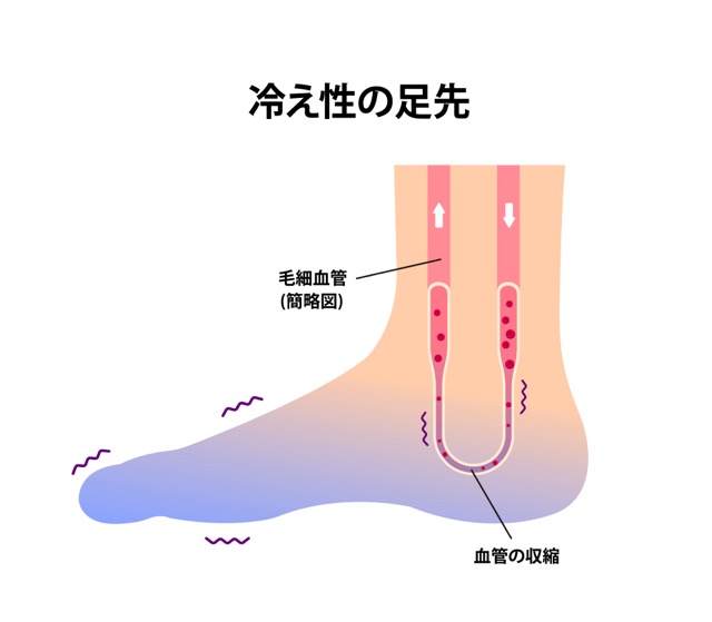 1. 血流を良くする